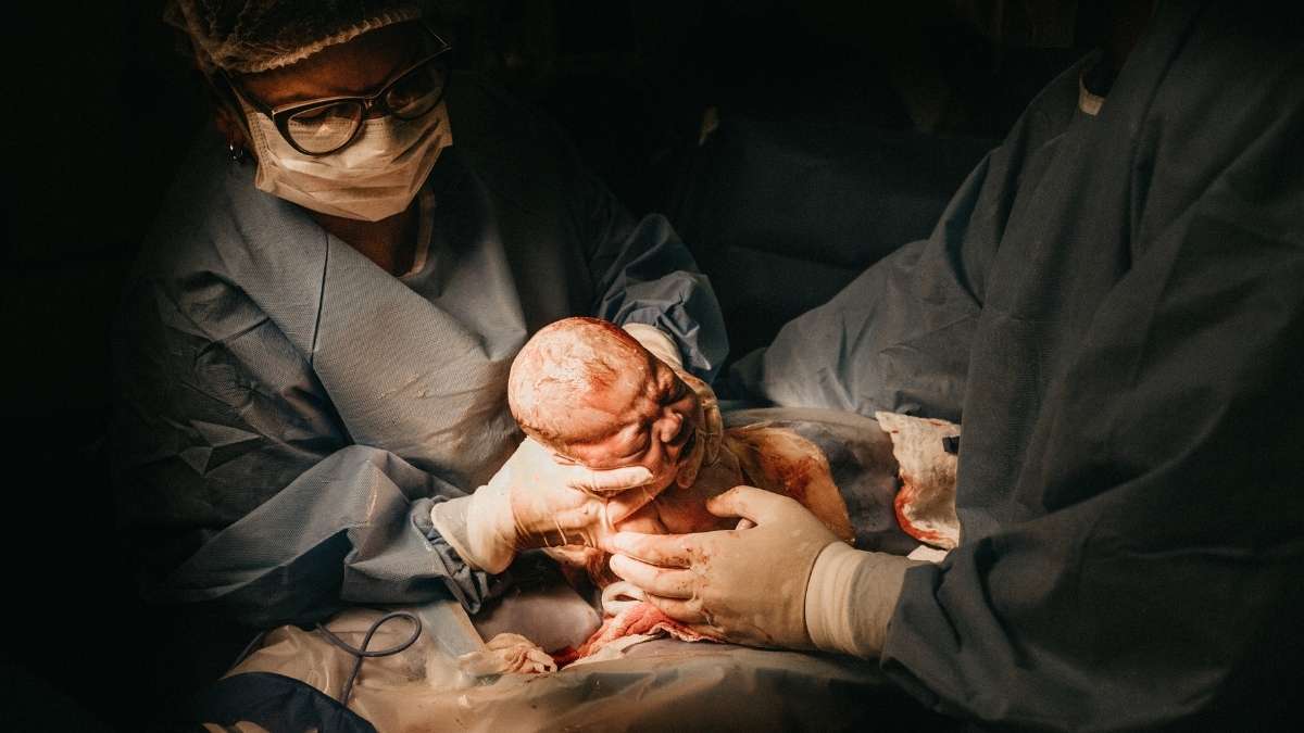 bebê nascendo cesárea